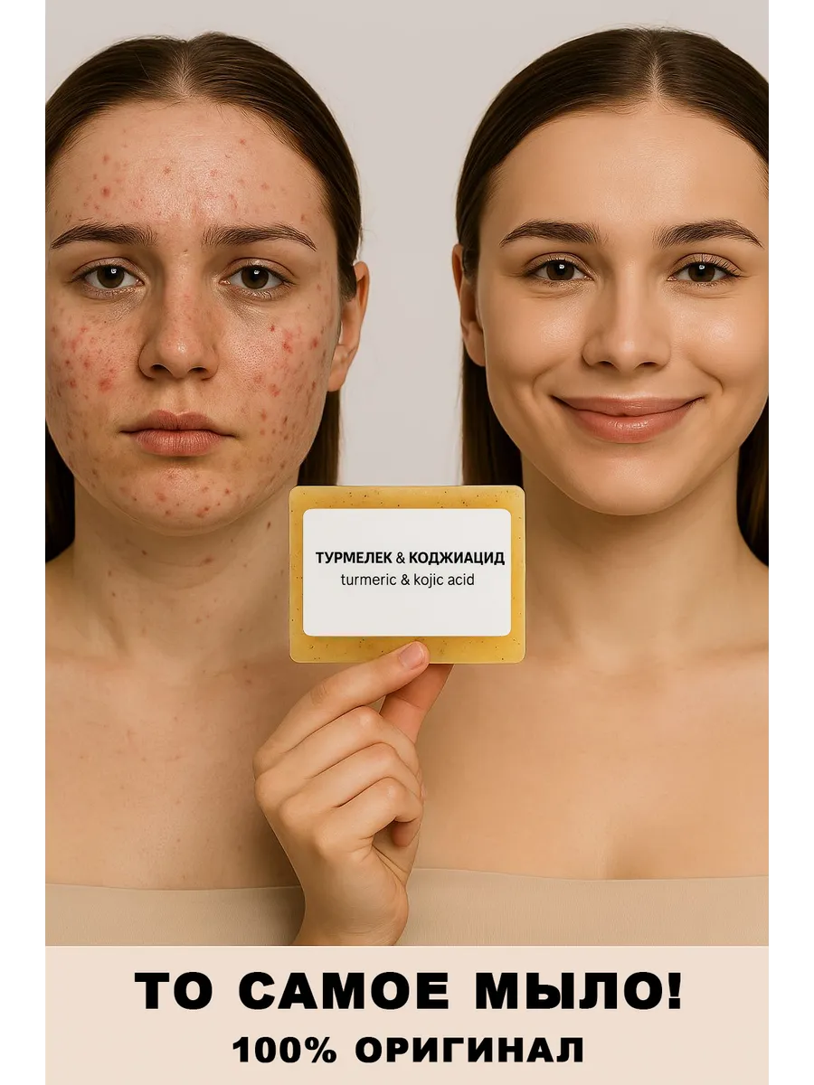 Мыло Турмелек от акне и воспалений